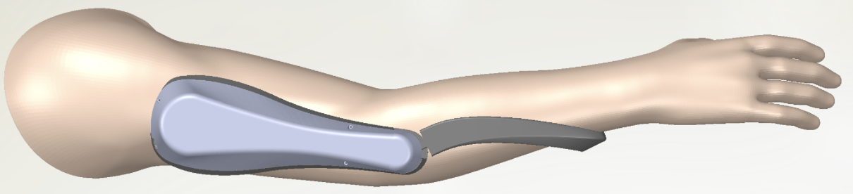 ArmAssist CAD full-arm view showing the complete orthotic support system